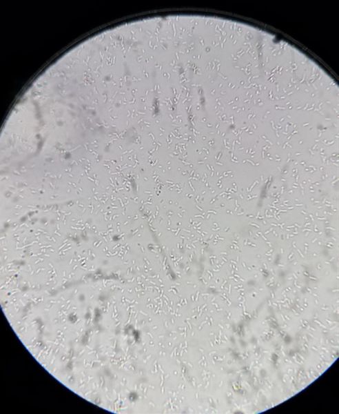 File:Omega-lacto-microscope.jpg